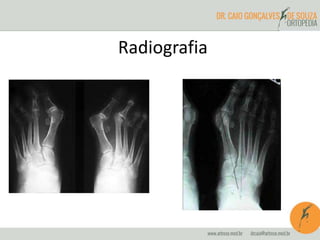 Radiografia 
 