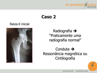 Caso 2 
Raios-X inicial 
Radiografia  
“Praticamente uma 
radiografia normal” 
Conduta  
Ressonância magnética ou 
Cintilografia 
 