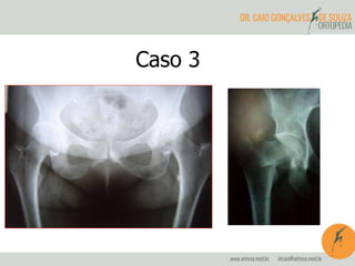 Caso 3 
 