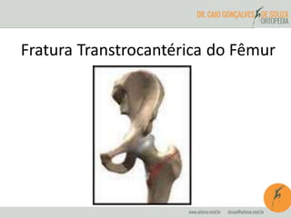 Fratura Transtrocantérica do Fêmur 
 