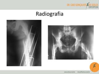 Radiografia 
 
