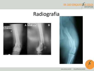 Radiografia 
 