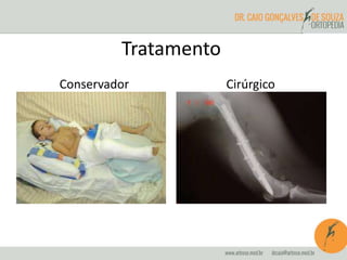 Tratamento 
Conservador Cirúrgico 
 