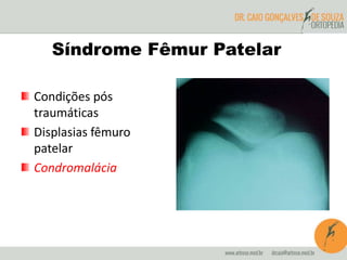Síndrome Fêmur Patelar 
Condições pós 
traumáticas 
Displasias fêmuro 
patelar 
Condromalácia 
 