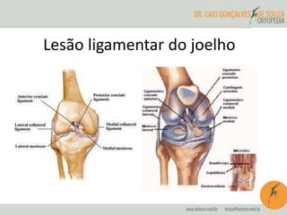 Lesão ligamentar do joelho 
 