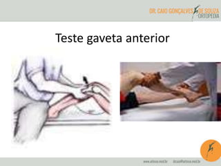 Teste gaveta anterior 
 