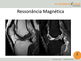 Ressonância Magnética 
 