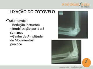 LUXAÇÃO DO COTOVELO 
•Tratamento 
–Redução incruenta 
–Imobilização por 1 a 3 
semanas 
–Ganho de Amplitude 
de Movimentos 
precoce 
 