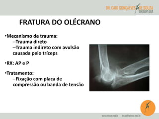 FRATURA DO OLÉCRANO 
•Mecanismo de trauma: 
–Trauma direto 
–Trauma indireto com avulsão 
causada pelo tríceps 
•RX: AP e P 
•Tratamento: 
–Fixação com placa de 
compressão ou banda de tensão 
 