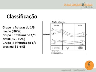 Classificação 
Grupo I : fraturas do 1/3 
médio ( 80 % ) 
Grupo II : fraturas do 1/3 
distal ( 12 - 15% ) 
Grupo III : fraturas do 1/3 
proximal ( 5 -6%) 
 
