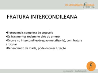 FRATURA INTERCONDILEANA 
•Fratura mais complexa do cotovelo 
•Os fragmentos rodam no eixo do úmero 
•Ocorre no intercondileo (regiao metafisária), com fratura 
articular 
•Dependendo da idade, pode ocorrer luxação 
 
