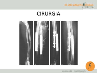 CIRURGIA 
 