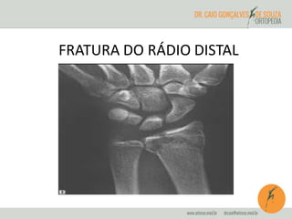 FRATURA DO RÁDIO DISTAL 
 