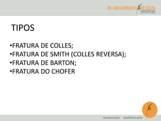 TIPOS 
•FRATURA DE COLLES; 
•FRATURA DE SMITH (COLLES REVERSA); 
•FRATURA DE BARTON; 
•FRATURA DO CHOFER 
 