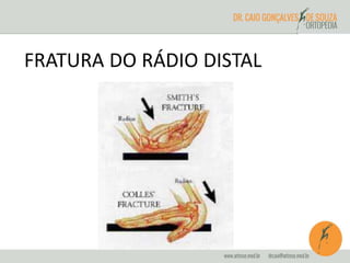 FRATURA DO RÁDIO DISTAL 
 