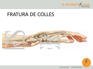 FRATURA DE COLLES 
 