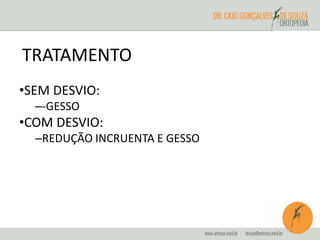 TRATAMENTO 
•SEM DESVIO: 
–-GESSO 
•COM DESVIO: 
–REDUÇÃO INCRUENTA E GESSO 
 