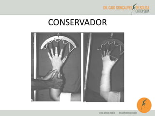 CONSERVADOR 
 