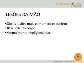 LESÕES DA MÃO 
•São as lesões mais comum do esqueleto 
•10 a 30% do corpo 
•Normalmente negligenciadas 
 