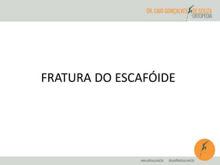 FRATURA DO ESCAFÓIDE 
 