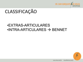 CLASSIFICAÇÃO 
•EXTRAS-ARTICULARES 
•INTRA-ARTICULARES  BENNET 
 