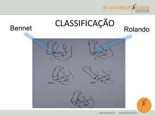 CLASSIFICAÇÃO 
Bennet Rolando 
 