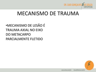 MECANISMO DE TRAUMA 
•MECANISMO DE LESÃO É 
TRAUMA AXIAL NO EIXO 
DO METACARPO 
PARCIALMENTE FLETIDO 
 