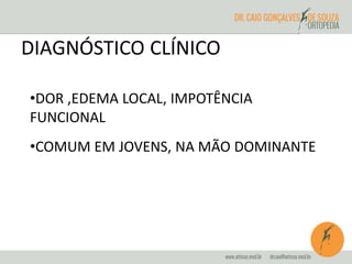 DIAGNÓSTICO CLÍNICO 
•DOR ,EDEMA LOCAL, IMPOTÊNCIA 
FUNCIONAL 
•COMUM EM JOVENS, NA MÃO DOMINANTE 
 