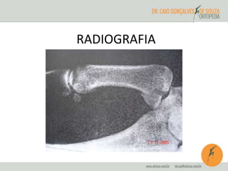 RADIOGRAFIA 
 
