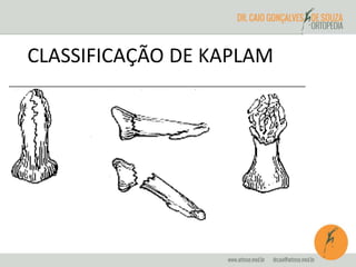 CLASSIFICAÇÃO DE KAPLAM 
 