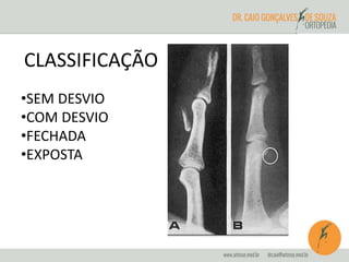CLASSIFICAÇÃO 
•SEM DESVIO 
•COM DESVIO 
•FECHADA 
•EXPOSTA 
 
