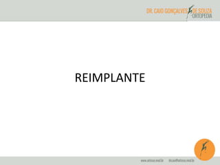 REIMPLANTE 
 