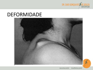 DEFORMIDADE 
 