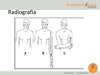 Radiografia 
 