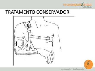 TRATAMENTO CONSERVADOR 
 