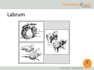 Labrum 
 