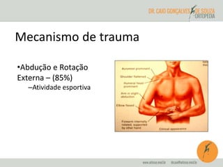 Mecanismo de trauma 
•Abdução e Rotação 
Externa – (85%) 
–Atividade esportiva 
 