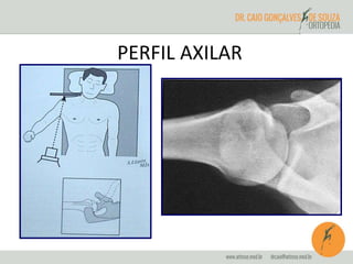 PERFIL AXILAR 
 