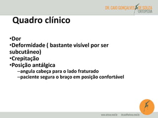 Quadro clínico 
•Dor 
•Deformidade ( bastante visível por ser 
subcutâneo) 
•Crepitação 
•Posição antálgica 
–angula cabeça para o lado fraturado 
–paciente segura o braço em posição confortável 
 
