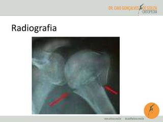 Radiografia 
 