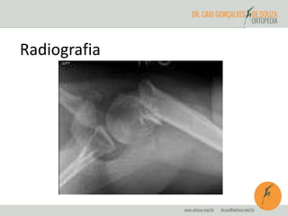 Radiografia 
 