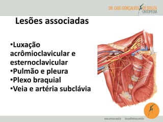 Lesões associadas 
•Luxação 
acrômioclavicular e 
esternoclavicular 
•Pulmão e pleura 
•Plexo braquial 
•Veia e artéria subclávia 
 