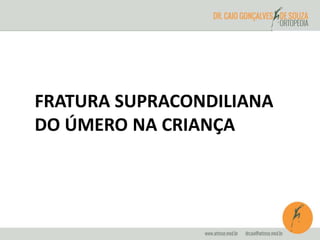 FRATURA SUPRACONDILIANA 
DO ÚMERO NA CRIANÇA 
 