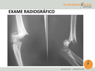 EXAME RADIOGRÁFICO 
 