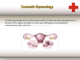 Row 1 Row 2 Row 3 Row 4
0
2
4
6
8
10
12
Column 1
Column 2
Column 3
Cosmetic GynecologyCosmetic Gynecology
Cosmetic gynecology aims to make improvements to either the physical appearance or
function of the vagina and labia; in many cases, both goals are accomplished
simultaneously. More Info Visit http://drchaitasi.com/
 