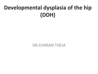 Developmental dysplasia of the hip 
(DDH) 
DR.CHARAN THEJA 
 