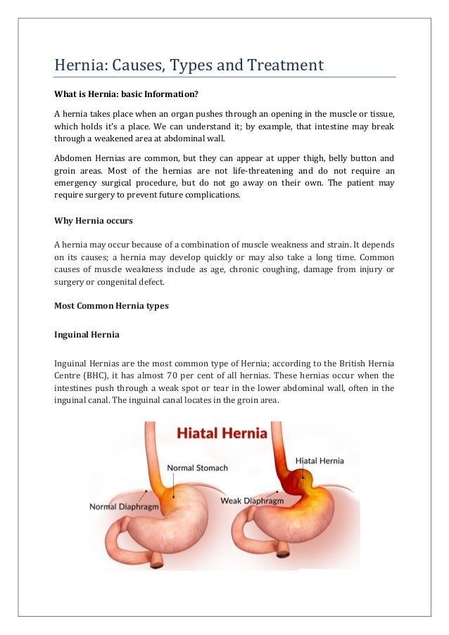Hernia : causes types and treatment