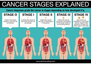 Dr Chris Nutting - Cancer Stages Explained