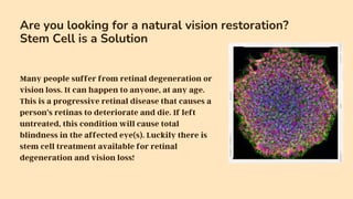 Dr David Green r3 Stem Cell Treatment for Retinal Degeneration.pptx