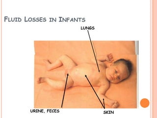 FLUID LOSSES IN INFANTS
LUNGS
URINE, FECES SKIN
 